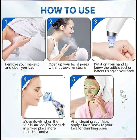 4 in 1 Blackhead Remover Device